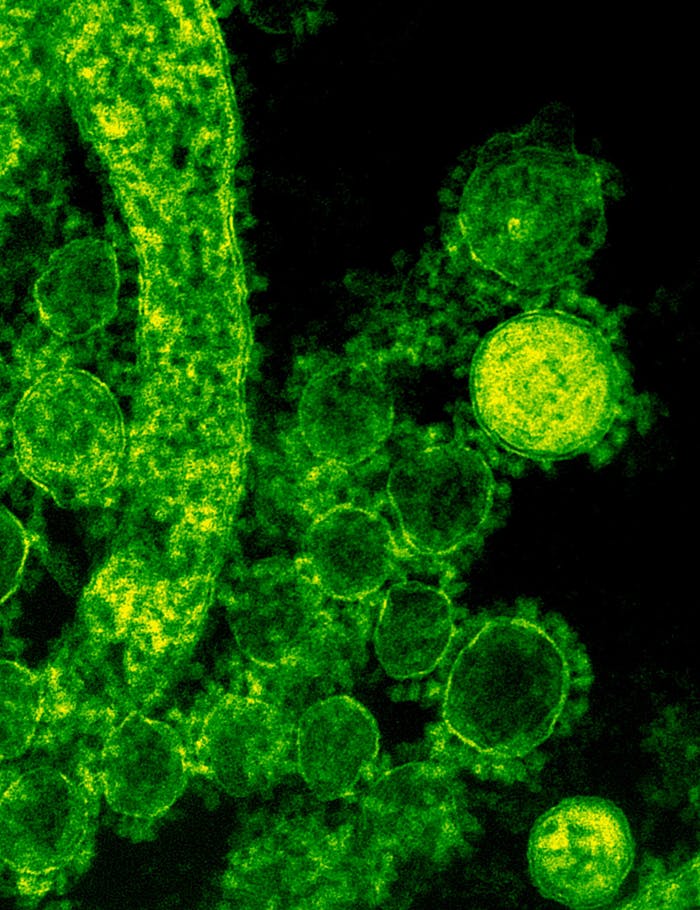 services-09 Green-tinted microscopic image of coronavirus particles illustrating viral structures.